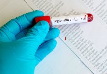 Nessun caso di legionella a Montanara: ora è ufficiale