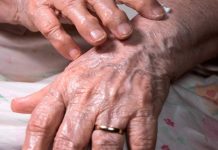 Un’80enne si rifiuta di fare sesso e il marito 90enne la picchia