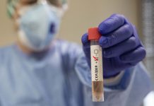 Coronavirus, allo Spallanzani isolato nelle lacrime di una paziente