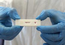 Covid, Asst dà il via ai test sierologici: previsti 500 esami al giorno