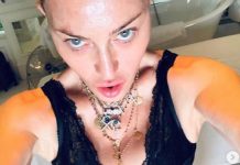 Madonna “Mi sottoporro’ a un intervento di medicina rigenerativa”
