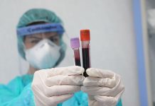 Coronavirus, 31.758 nuovi casi e 297 morti nelle ultime 24 ore