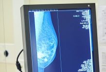 Tumore al seno, Europa Donna “Test genomici non ancora rimborsati”