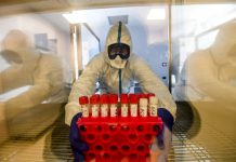 Covid, 1.820 nuovi casi e 82 decessi nelle ultime 24 ore