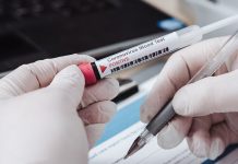 Sabato quasi in bianco: uno solo caso di Covid nel Mantovano (a Marcaria)