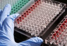 Malattie rare, al via una campagna di Sanofi sulle terapie domiciliari