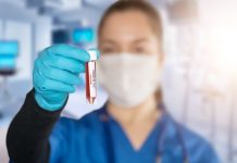 Il virus circolava già nel gennaio 2020. A Mantova 12 contagi fantasma