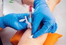 Ceresara: riapre il centro prelievi al primo piano del palazzo comunale