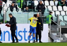 Allegri “Dybala? In linea con la società, con l’Inter gioca”