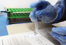 Covid, incidenza in salita