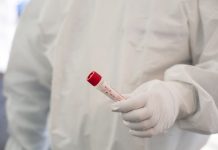 Covid, in Italia 84.700 casi e 63 decessi nelle ultime 24 ore