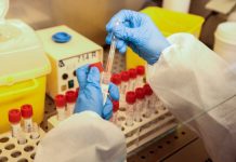 Covid, 48.714 nuovi casi e 120 decessi nelle ultime 24 ore