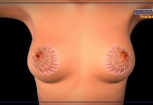 Tumore al seno, la sopravvivenza a 5 anni dalla diagnosi è dell’88%