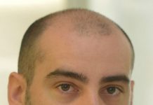 San Martino – Stop ai lavori per ciclabile ed ex cinema Il sindaco: “Ripartiranno dopo Pasqua”