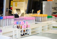 Quistello: riprende lunedì 3 aprile l’attività del Cup e punto prelievi