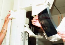 Tumore al seno, i test genomici rafforzano i percorsi di cura