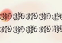 Malattia Renale Cronica, a lavoro su prevenzione e impatto economico