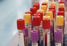 Botulino, dal 2001 al 2024 segnalati 1.276 casi in Italia