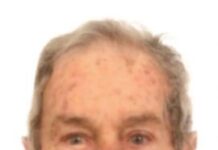 Morto dopo la lite: via alla perizia sul 60enne accusato di omicidio preterintenzionale