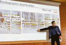 Implantologia conservativa: gengive sane fanno bene al cuore!