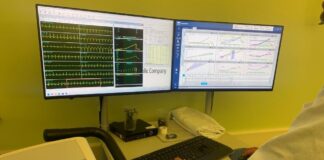 Test ergospirometrico: al Poma un esame completo per valutare cuore e polmoni sotto sforzo