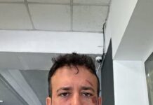 Drone russo cade vicino al taxi: ferito ad Odessa il segretario provinciale del Pd